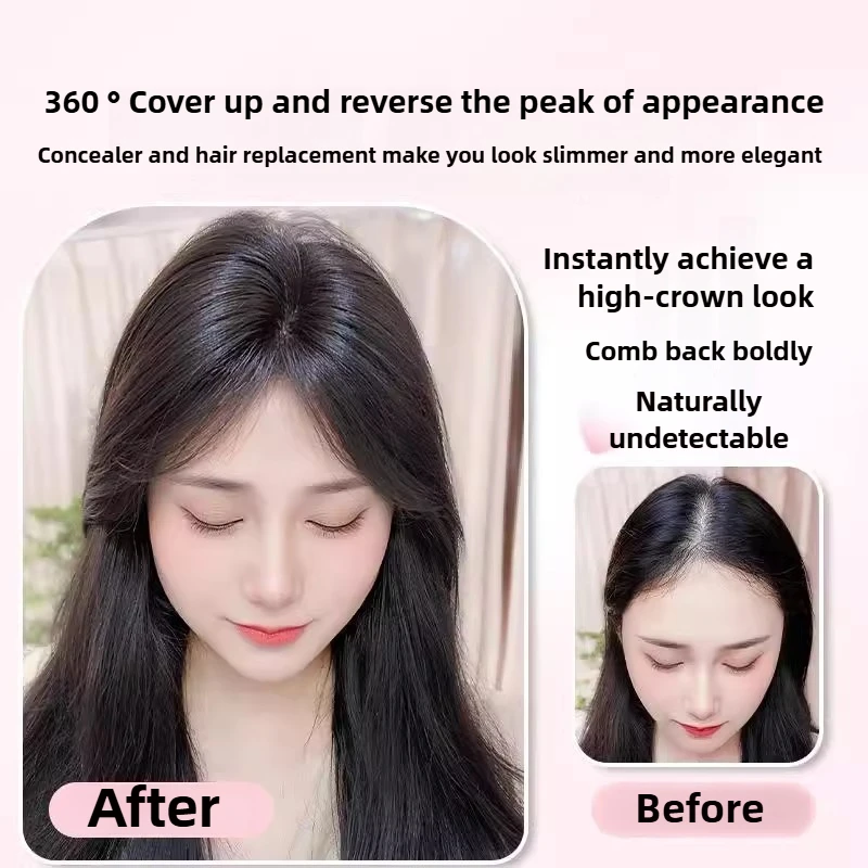 Top Wig Pieces for Women Synthetic Closure Casual Hair Lifting Hand-woven Lace Middle Parted Bangs for Hair Replacement