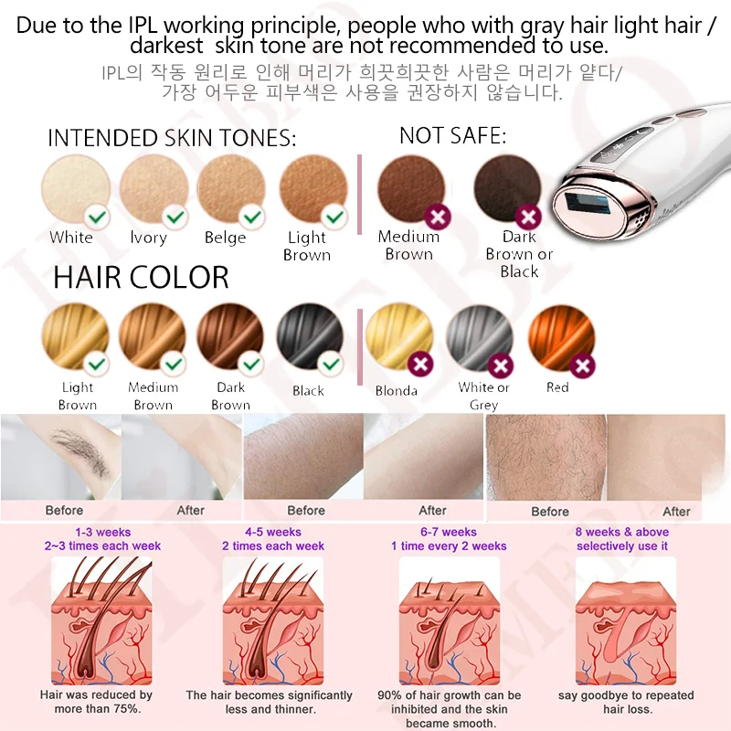 Yoodragons-脱毛用レーザーデバイス,脱毛器,アイケア,6つのレバー,顔の部分の脚,ビキニライン,全身