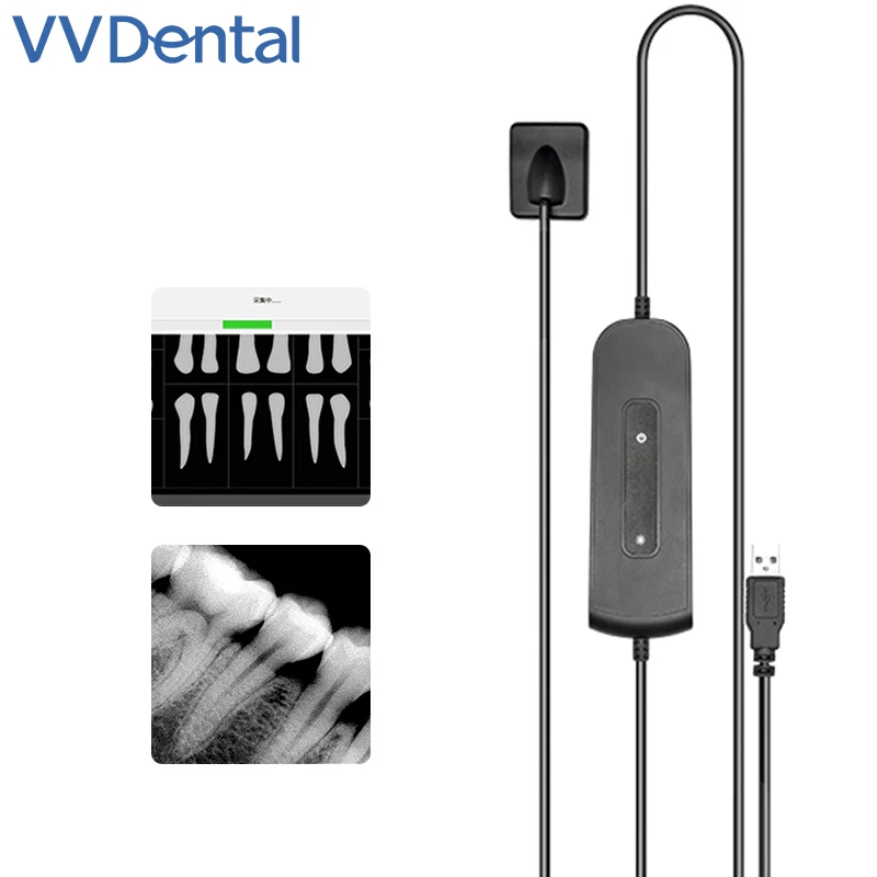 VVDental Dental Sensor X-Ray High-Frequency Rx Intraoral Digital System HD Image Radiovisografo Dental Digital Sensor