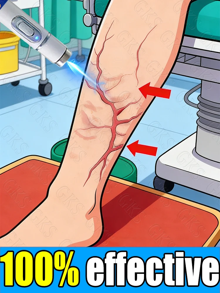 Newly upgraded to improve leg problems