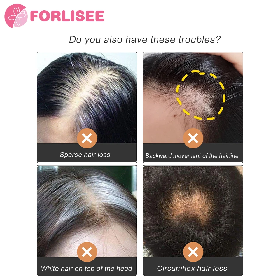 FORLISEE Synthetic Wig Head Top Summer Hair Increase High Head Top Fluffy Natural Hair Replacement Block