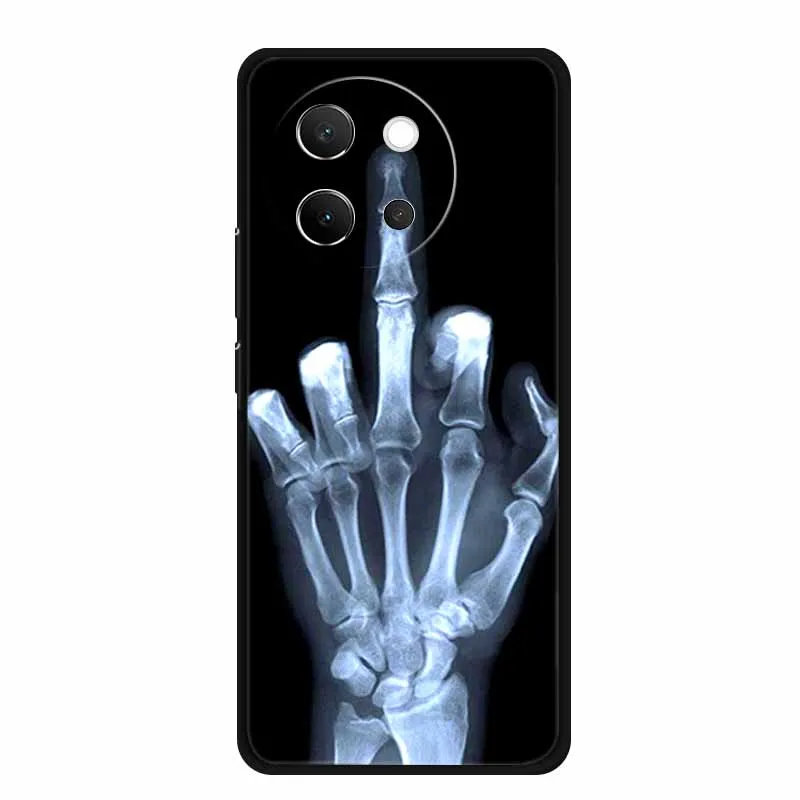 For Vivo V40 Lite Case Black Silicone Soft Back Cover Case For Vivo V40 Lite 5G Phone Case Cover V 40 V40lite 6.78\