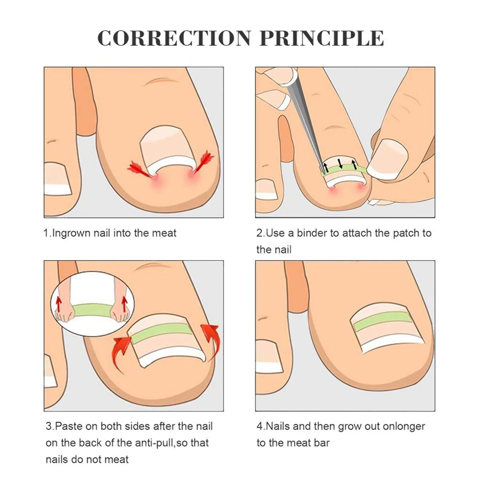 50 Pcs Toenail Straightening Sticker Stickers Corrector Ingrown Tape Toenails Thick Correction Kit Strips Brace Foot