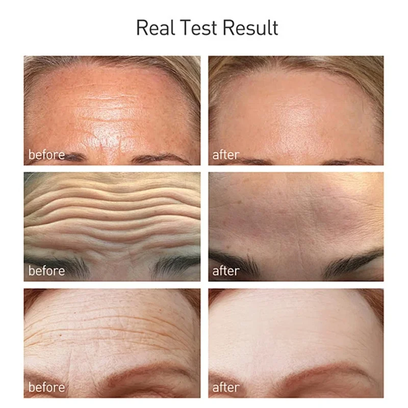 

Anti-Wrinkle Firming Face Cream Moisturizing Tender Nourishing Delicate Tighten Fade Fine Lines Beauty Skincare Korean Cosmetics