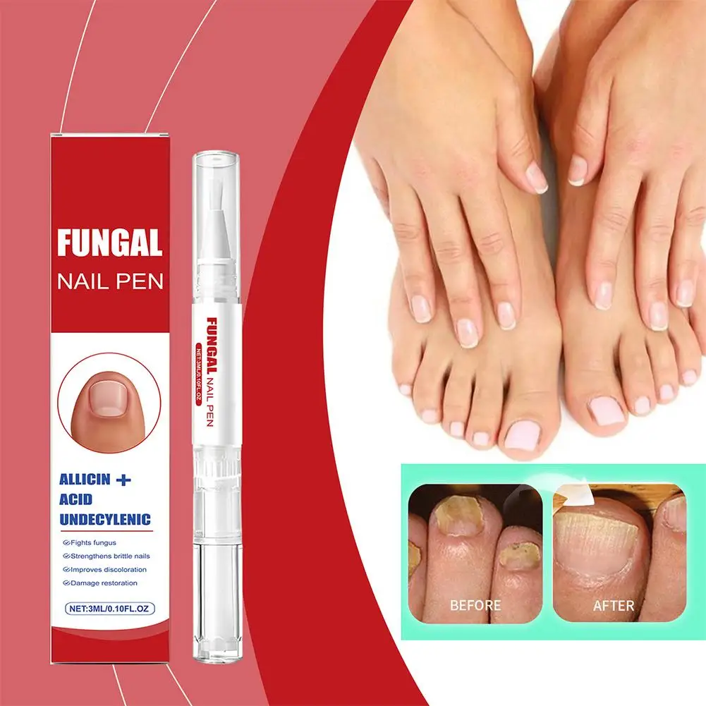 قلم العناية بالأظافر من FUNGAL، إصلاح الأظافر القوي للغاية، رعاية مغذية لأظافر القدمين السميكة أو التالفة باللون الأصفر #1