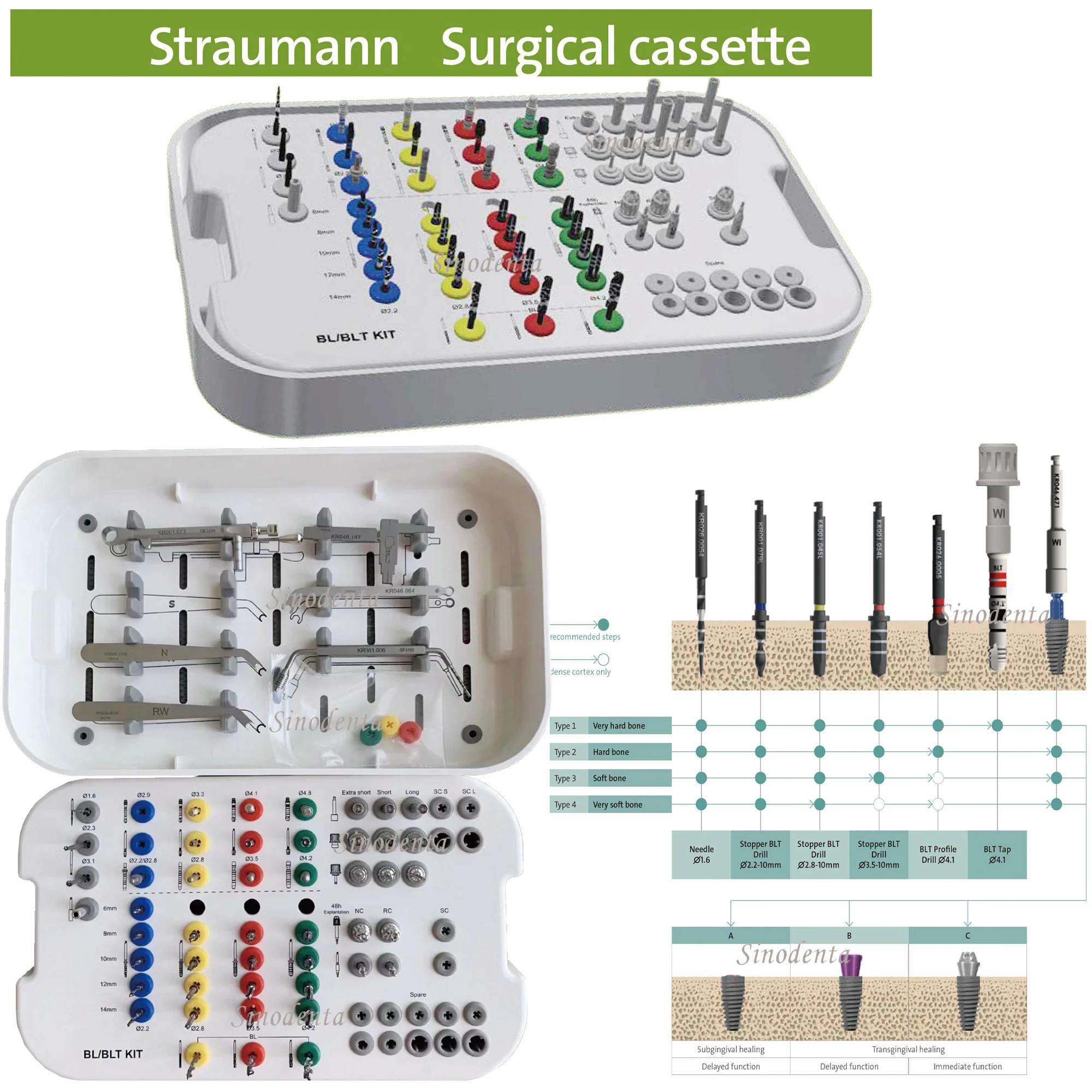 2025ชุด BLK ชุด BLK bl/blt ชุดทันตกรรมชุดเครื่องมือทันตกรรมรากฟันเทียม Straumann BLK/bl/blt/sp