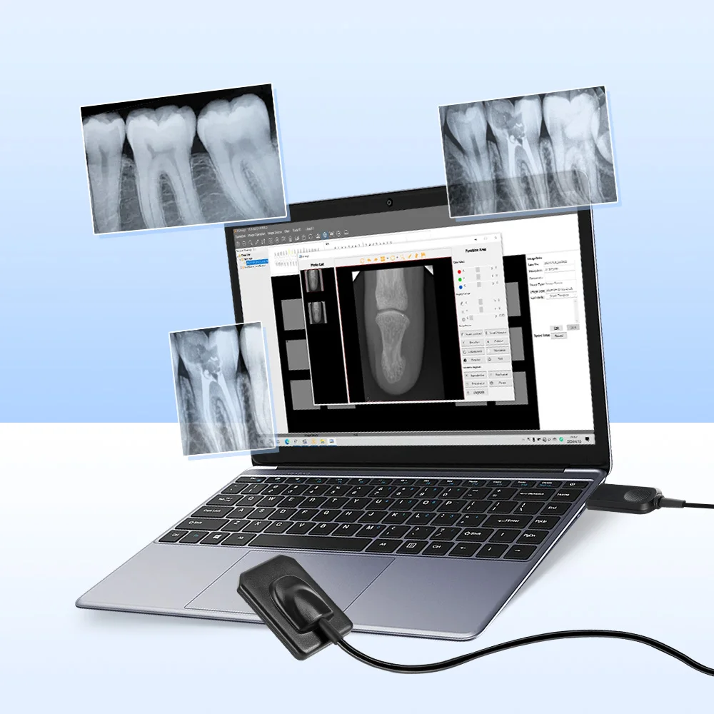 AZDENT Handy Dental Sensor X-Ray Digital Sensor Intraoral Digital System HD Image Dentistry Tools