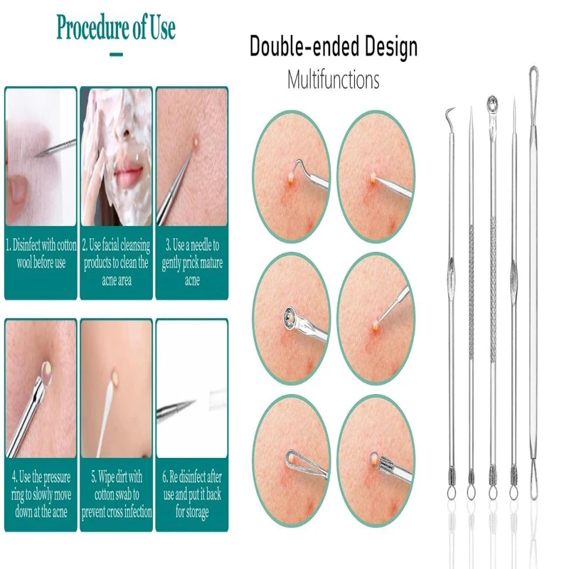 

8PCS/lot Blackhead Remover Kit – Stainless Steel Blemish & Extraction Tools – Professional Pimple Popper Set for All Skin