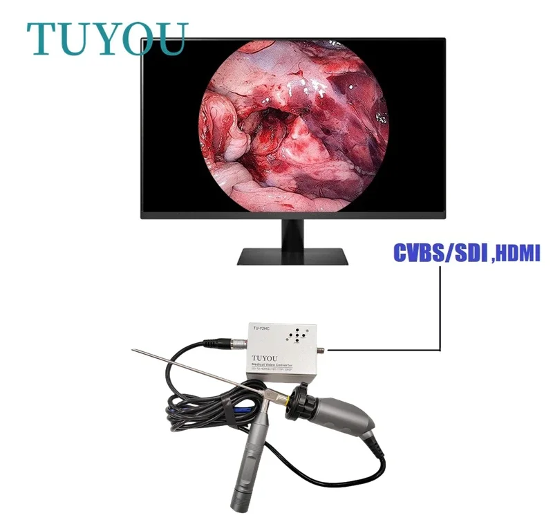 Tuyou Full HD Portable Medical Endoscop Camer Unit ENT Endoscop