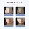 Máquina de adelgazamiento de celulitis en forma de S, Ultra cavitación 30k, vacío RF Spa 6