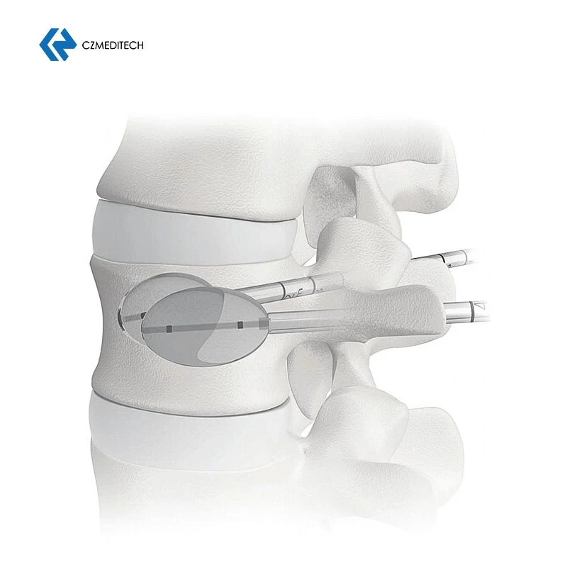 New Design  Spinal Surgery PKP Set Kyphoplasty Ballon And Tool System Thoracic Layer by Layer Puncture