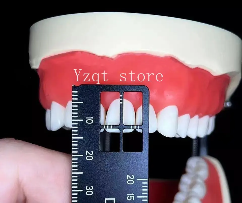 Teeth spacing Multifunctional measuring ruler Dental equipment Dental measuring tools Oral cavity