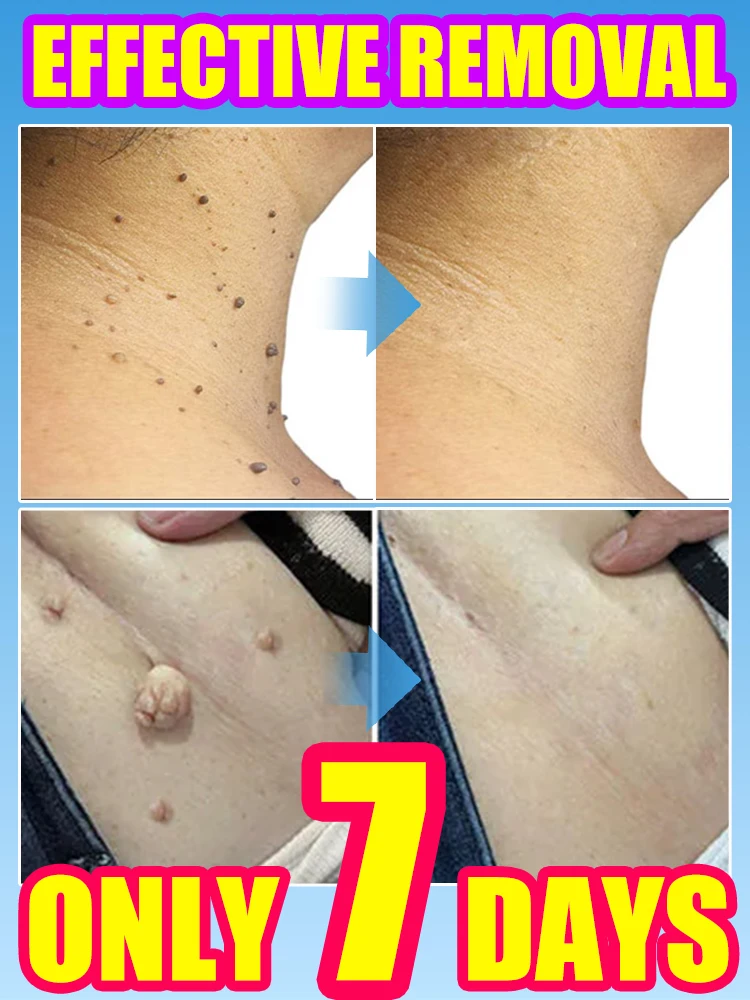 Fss slaapt Oversight