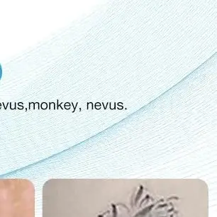 

Mini Mole Pen Electric Beauty Spot Pen Remove Mole Spots Warts Fat Granules Tattoos Remaval Tool Beauty