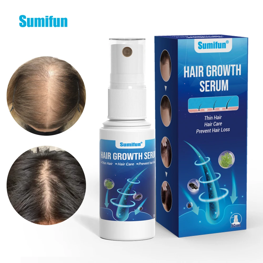 

1/2/3Pcs Sumifun Anti Alopecia Spray Prevent Baldness Regrowth Hairs Root Nourish Hair Growing Damaged Thin Hair Care Plaster