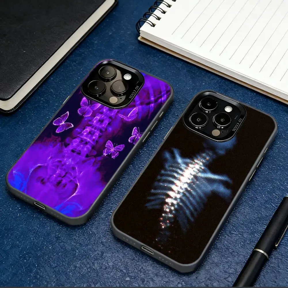 Bone Xray Phone Case For iPhone 17,16,15,14,13,12,11 Plus,Pro Max,XS,Colorful Silver Black Cover