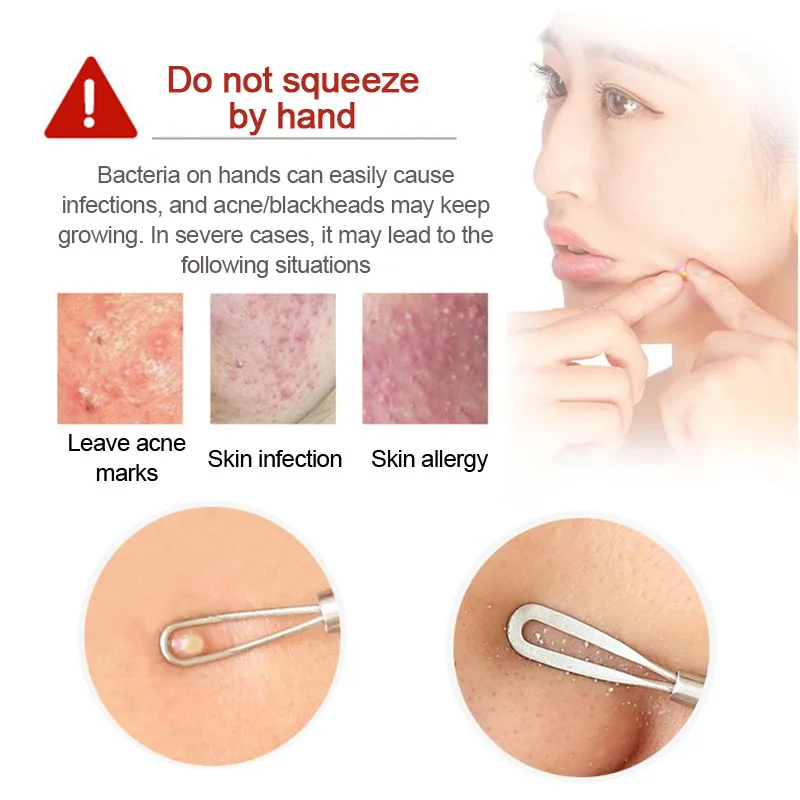 1/2/3pcs 블랙헤드 제거 도구는 블랙헤드와 블랙헤드 여드름 도구를 빼냅니다. 블랙헤드 리무버 페이스 클린 도구 FCZ03