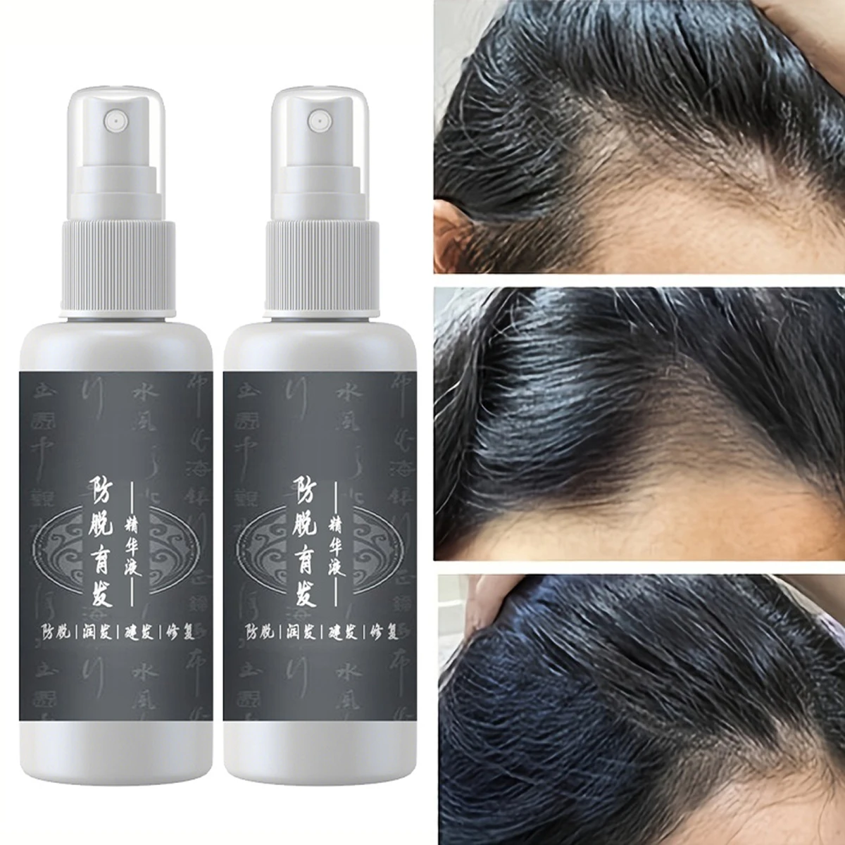 Hair Tonic Serum Fast Hair Growth Serum Hair Tonic For Men & Women Hair Growth Anti Hair Fall Hair Loss Serum