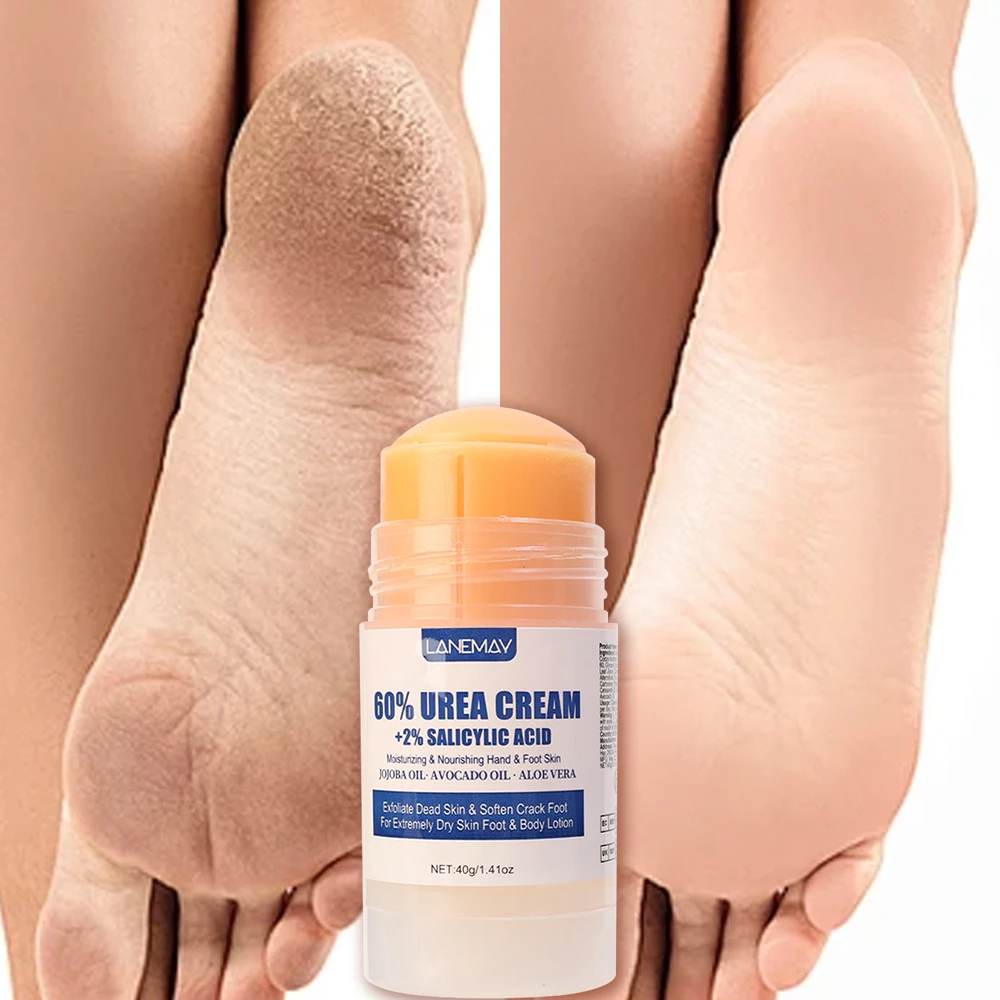 Anti-Drying Cracking Foot Heel Cream Repair Exfoliation Removal Dead Skin Softening Moisturizing Smooth Hand Feet Skin Care Tool