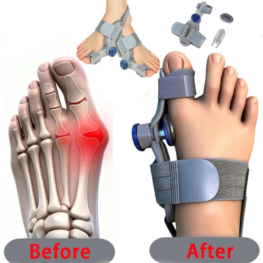 Unisex Bunion Corrector Toe Separator Hallux Valgus Pain Relief Adjustable Big Toe Straightener Bunion Splint with Straightener