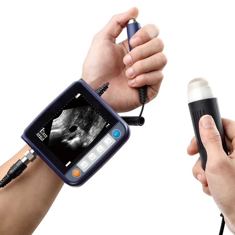 Portable Ultrasonic Diagnostic Devices Type Portable Ultrasound Scanner for Pets and Animal