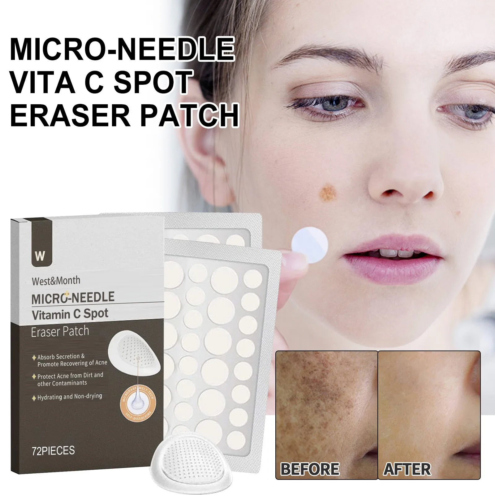 

72pcs Niacinamide Dark Spots Remover Patches Whitening Freckles Corrector Pimple Spot Scar Stickers Acne Mask Skin Care Products