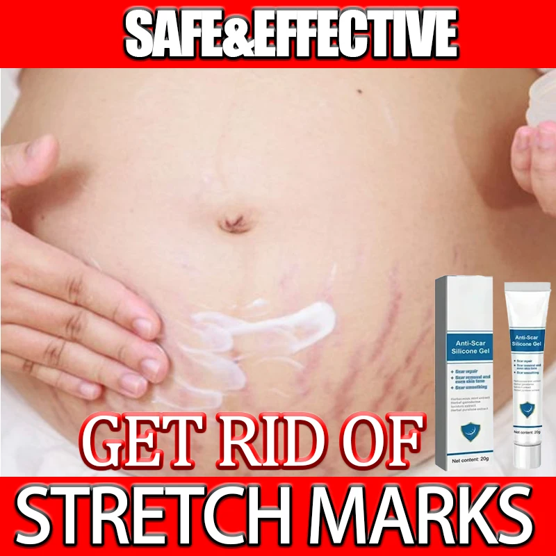 

Cream For Pregnancy Stretch Marks Removal Eliminate Red White Old Stretch Marks