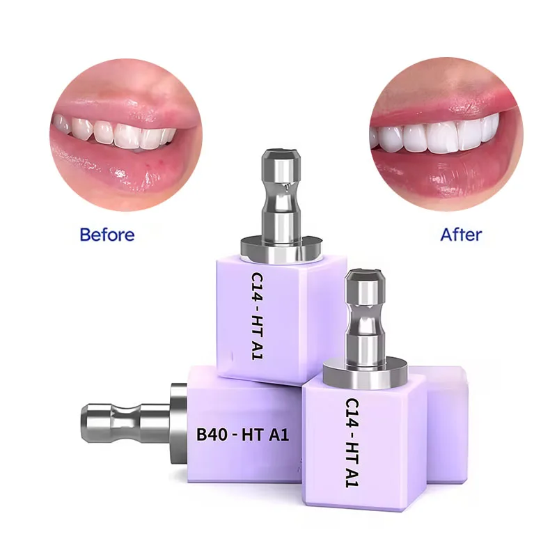 Dental Materials All-Ceramic Dental Crown Glass-Ceramic Blocks Aesthetic Chairside Restoration Ceramic Blocks Dental Laboratory