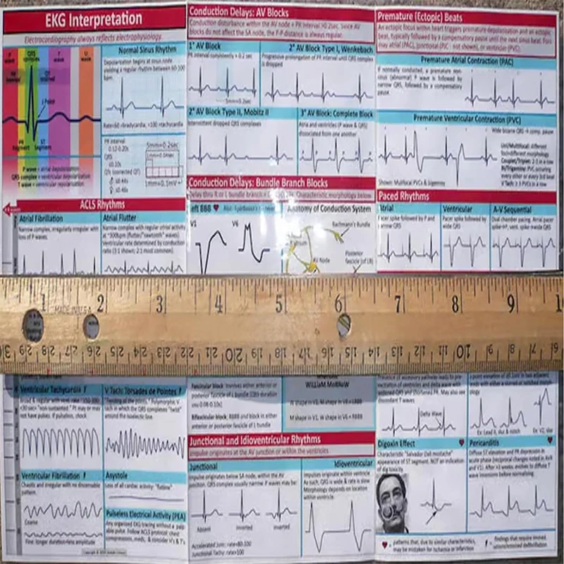 EKG إيقاع دليل الجيب خريطة جيب مخطط كهربية القلب الذاتي قياس البيض موصلات قياس الدقة أداة منزلية #5