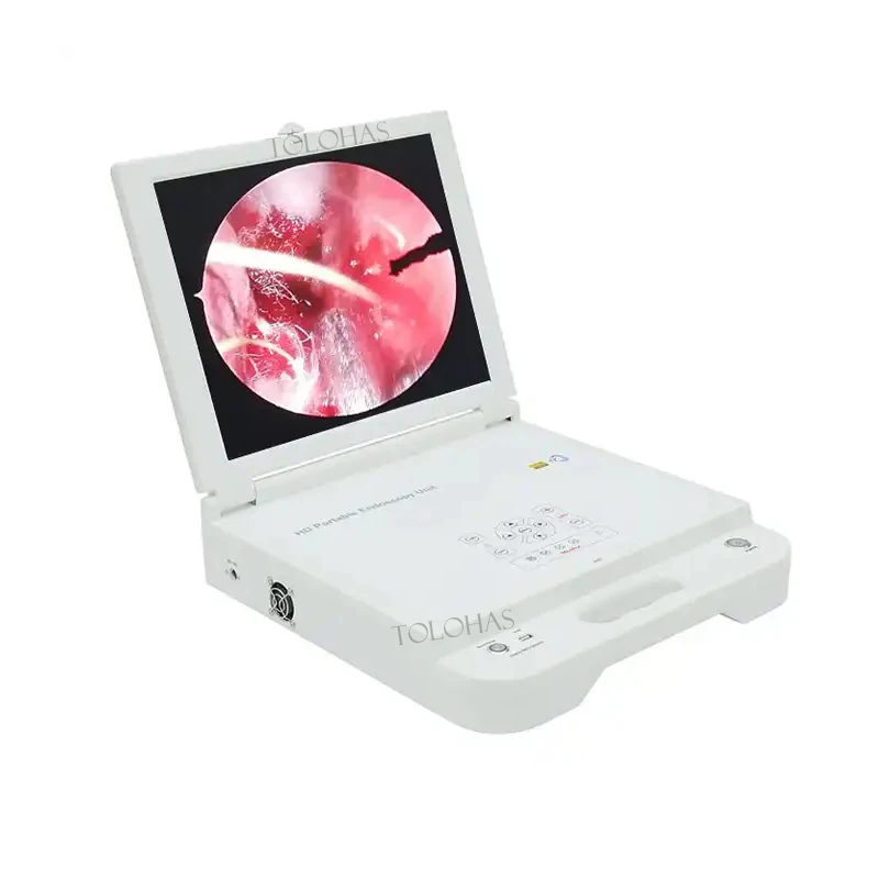 

LHGW612 Portable HD Medical Monitor Led Light Source ENT CCD Camera Portable Endoscopy Unit