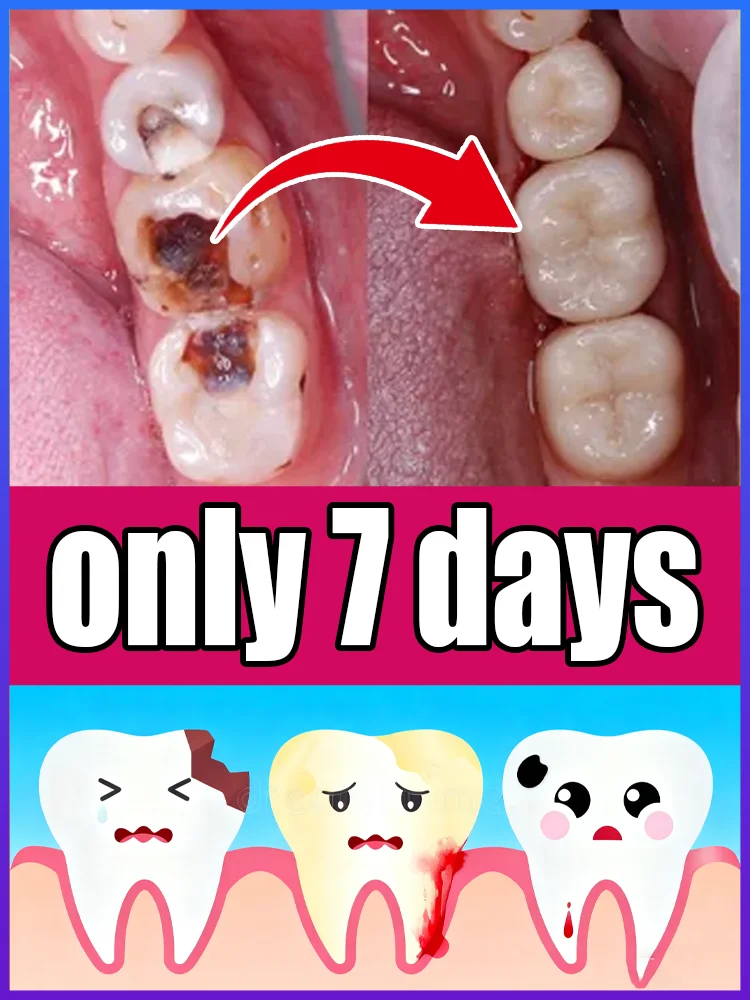 

Say goodbye to cavities in 7 days