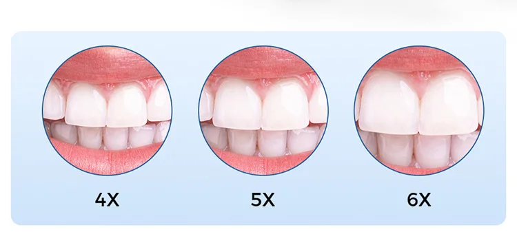 AZDENT Chirurgische Lupe, Dentale Vergrößerungslupe mit 5W LED-Kopfleuchte, Schraubbare IPD-Einstellung, 4,0X 5,0X 6,0X Vergrößerung für Zahnmedizin – Detail 7