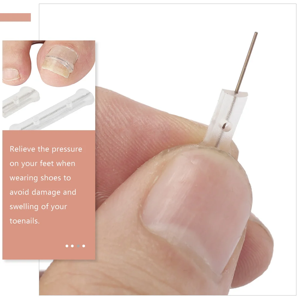 

Titanium Alloy Silicone Toenail Corrector Ingrown Nail Repair Tool Reusable Wear-Resistant Foot Care Device Compact Daily