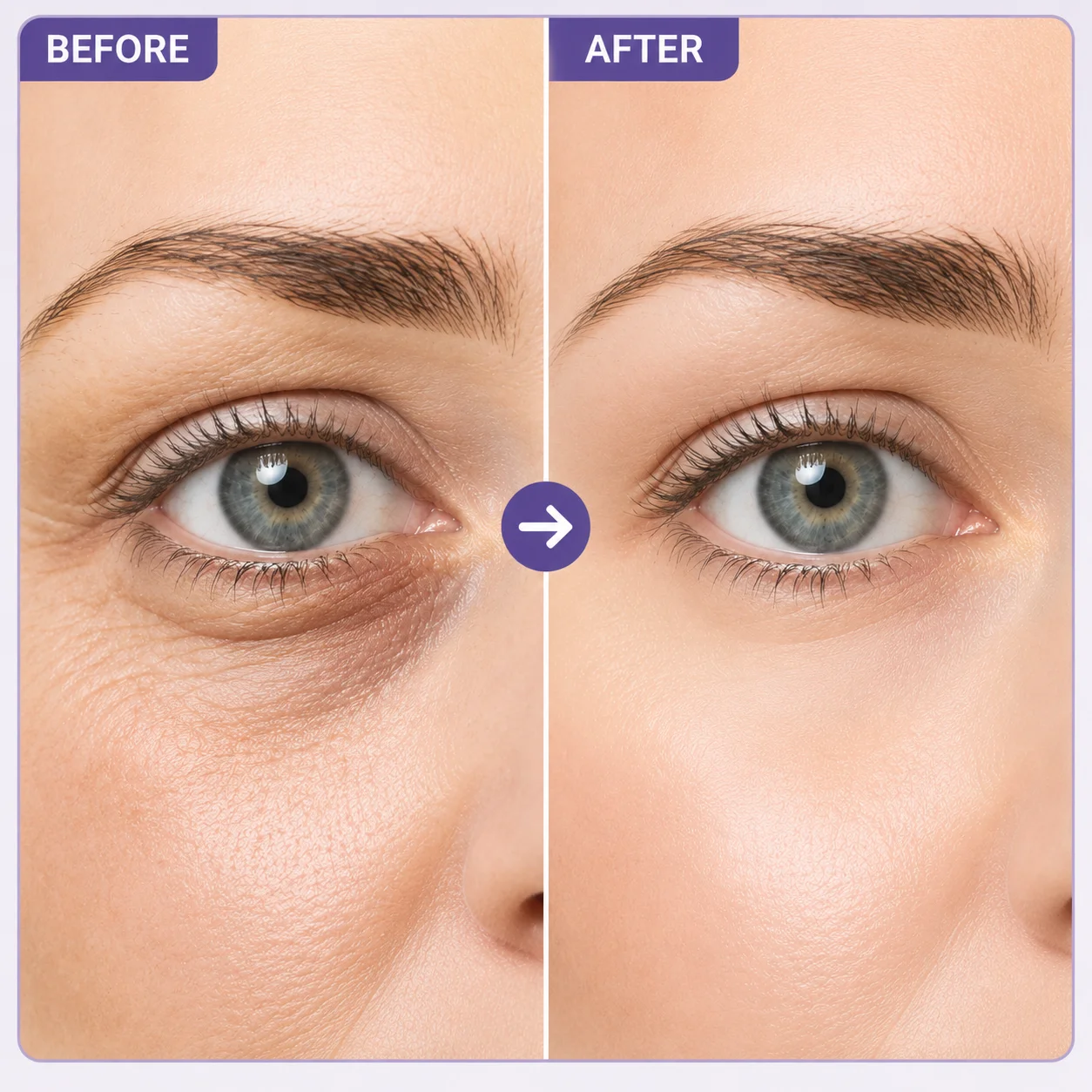 Instant Lift Eye Gel, For the Look of Puffiness & Bags, Fine Lines and Dark Circles, Skin Care for Unisex, Under Eye Brightener view 4