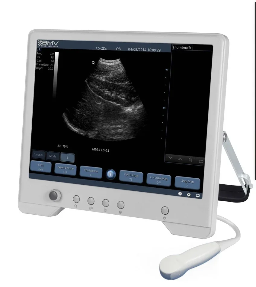 TS20 Veterinary ultrasound portable ecografos for cats dogs