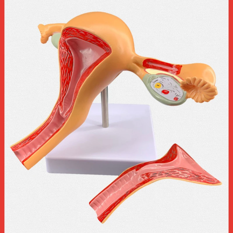 Anatomy of reproductive organ structure in Zhenghe female uterus model for human body teaching, pathology, ovary hospital and