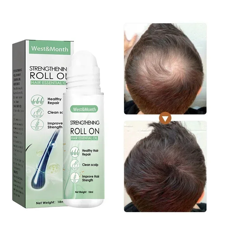 Suero de crecimiento rápido para el cabello, tratamiento para el cuidado del cabello, belleza, salud, reparación hidratante, cabello dañado, productos Coreanos para el cuidado del cabello