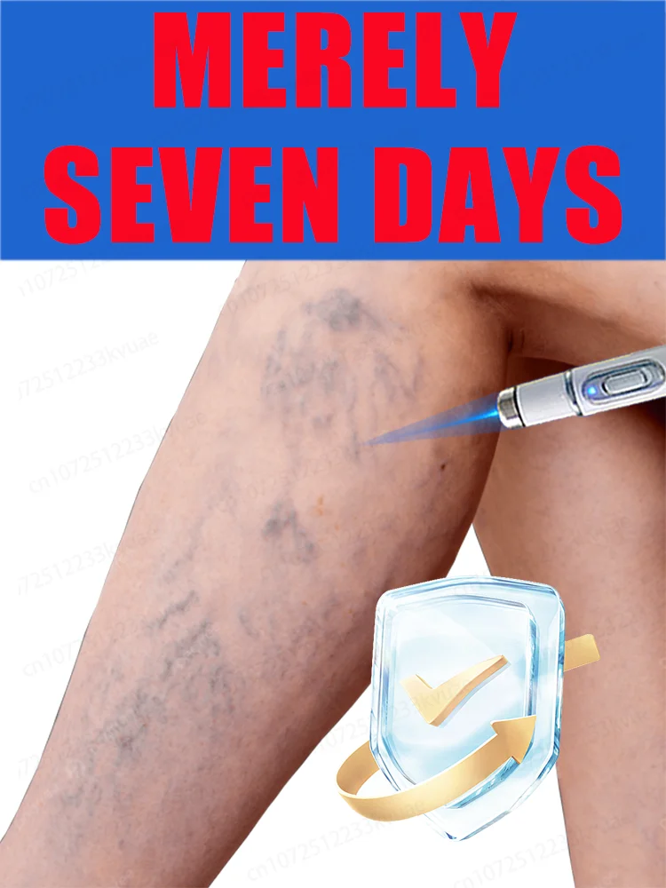 

Leg vein repair light, leg vein patch, deformed and damaged, body care, 2025