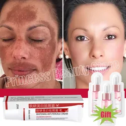 Potente crema blanqueadora Para manchas, aclara la piel rápidamente, elimina la pigmentación de melanina, Melasma, manchas oscuras, cuidado de la piel coreano