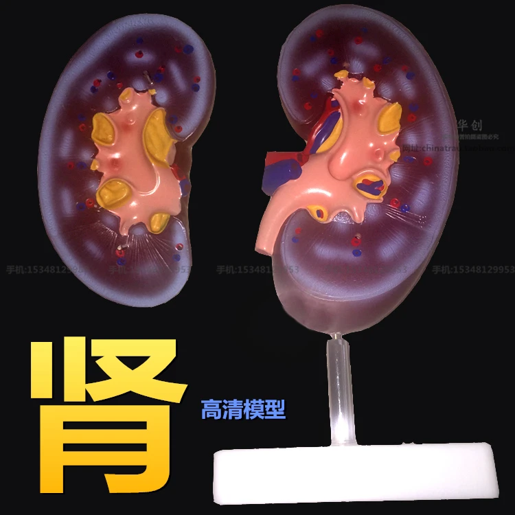 Medical kidney anatomy model of human medicine kidney ball section of teaching and training of special ureteral function