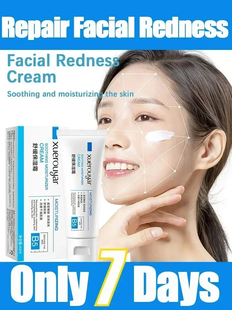 

Instant Repair Facial Redness Cream Soothing Redness Repair Skin Rosacea Red Blood Improve Sensitive Skin Care Korean Cosmetic