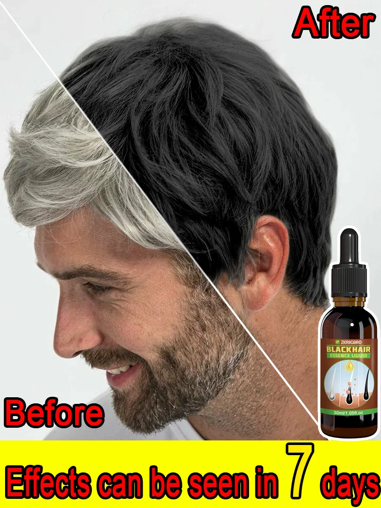 

Worried about gray hair Use black hair essence and get black hair in 7 days