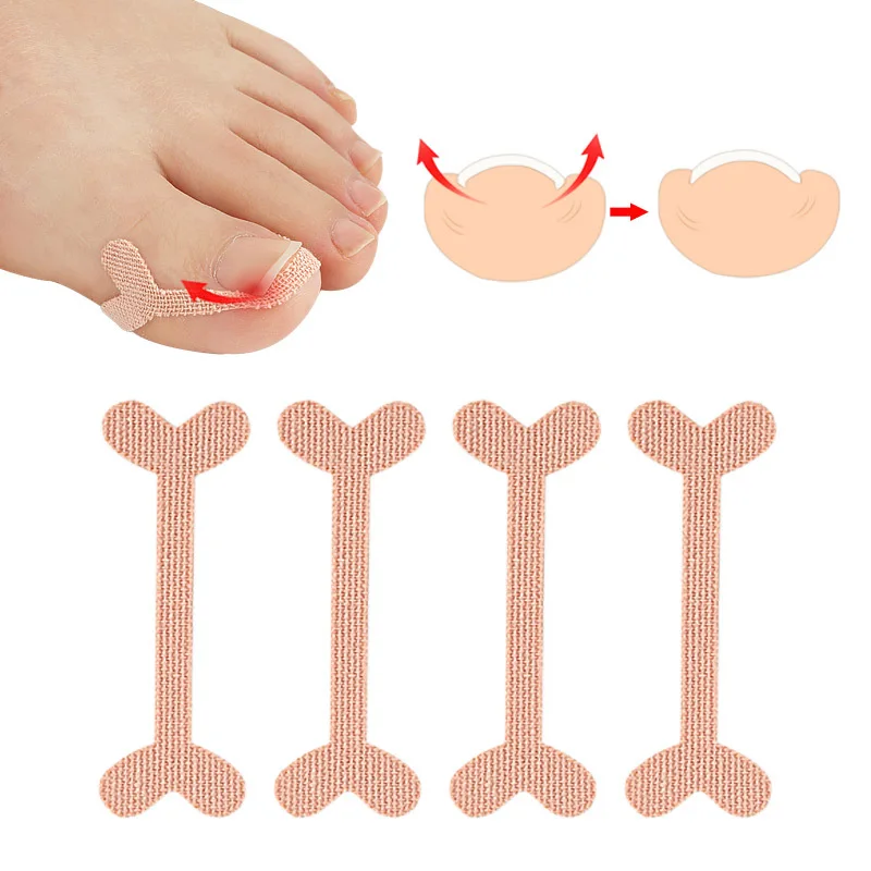 20pcs Professional Embedded Toe Nail Corrector Sticker Toenail Care Pedicure Thumb Curl Correction Sticker