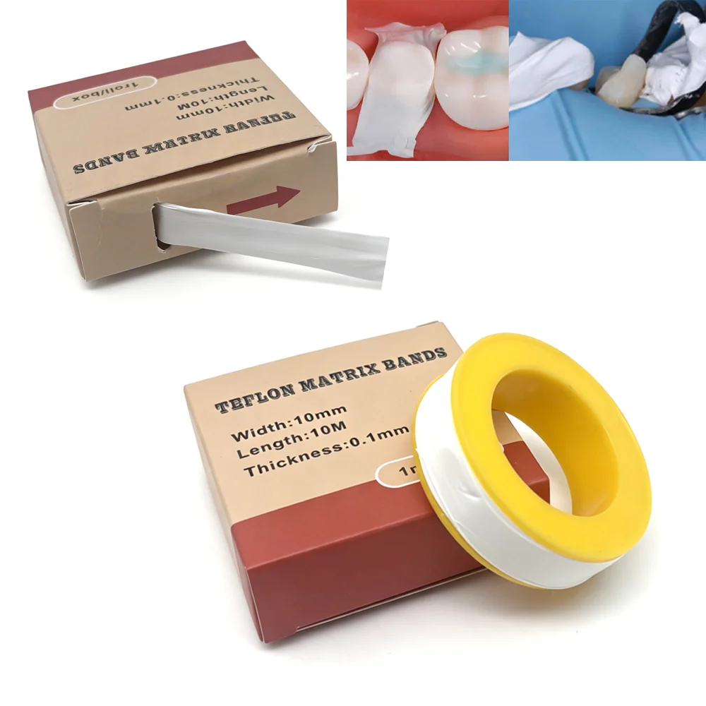 High-quality dental Teflon matrix strips, 10-meter roll for posterior tooth restoration