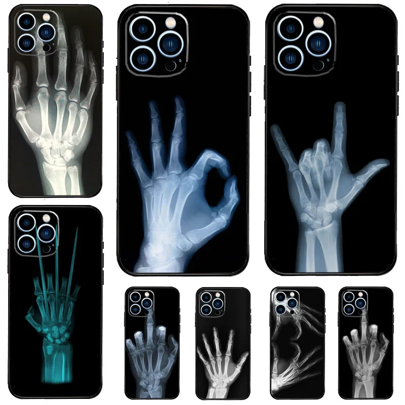 X-ray Hand Bones Case For Samsung Galaxy M33 M15 M20 M51 M31 M21 M35 M16 M36 M56 M53 M32 M22 M55 M14 M34 M54