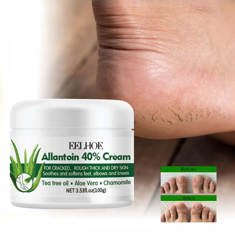 Foot care cream heel Dead skin removal Callus anti dry Cracked peeling hydrating moisturize exfoliation chapped repair feet mask