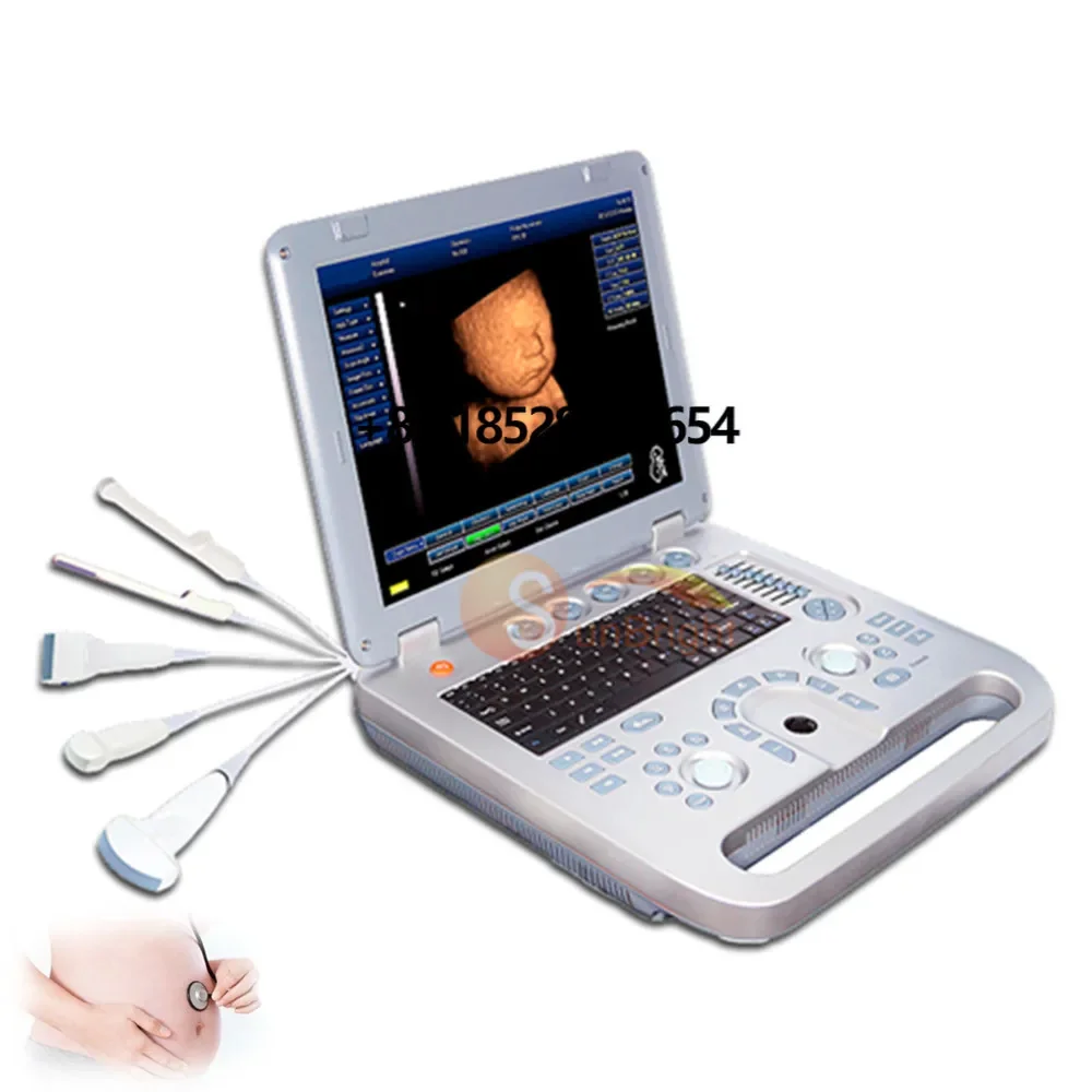 

Medical High Quality SUN-800D Sunbright Ultrasound Scanner Machine Black/White 3D Ultrasound Machine