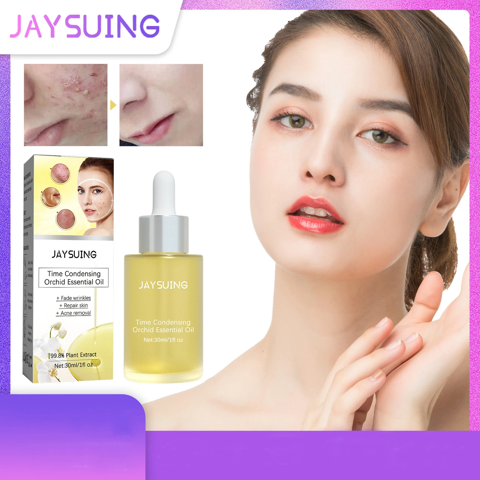 Orchid Acne Removing Essential Oil Blackhead Acne Imprint Pit Cleaning Brightening Facial Repair essence