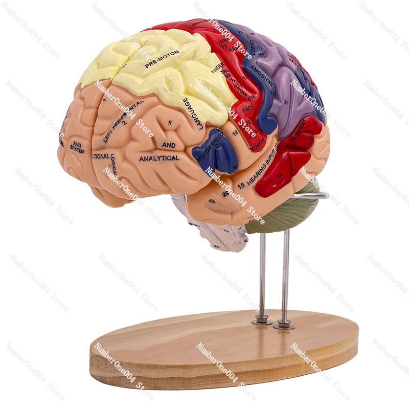 

For 2 Times Magnification 4 Parts Brain Attached Cerebral Artery Model Cerebrovascular Model Neurology Human Brain Anatomy Model