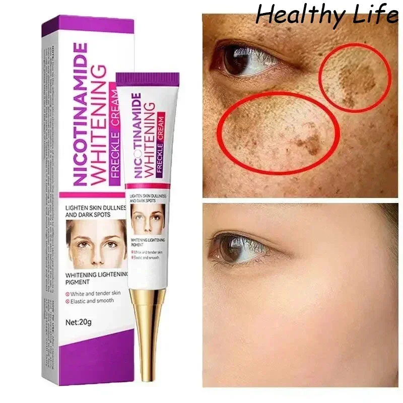 

Mild Niacinamide Lightening Melasma Cream Effectively Fade Melanin Bleaching Cream Remove Dark Pigment Moisturizing Skin Care